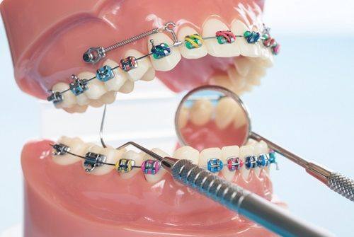 西安双宝口腔医院收费标准高不高？这里为你揭晓，价格合理超值得了解！ 