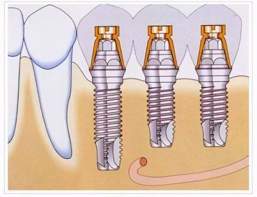 总结:南京固德口腔医院值得选择
