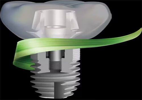 苏州牙博士口腔医院的服务特色