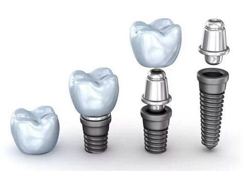 南京美奥口腔靠谱吗？是正规医院吗？资质、技术、服务和收费全解析