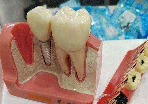 北京美冠塔口腔有哪些特色项目?专为中老年人设计