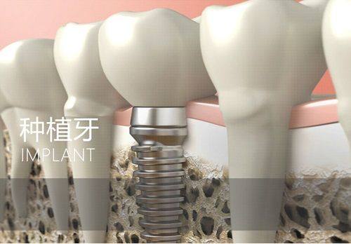 南京美奥口腔特色分享及收费表