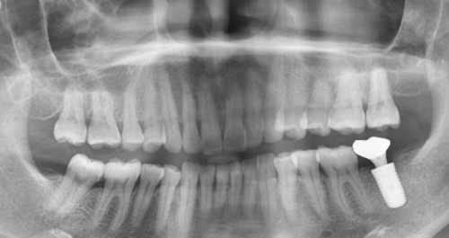 北京美冠塔口腔是正规医院吗？它资质齐全技术靠谱，是值得信赖的口腔诊疗机构 