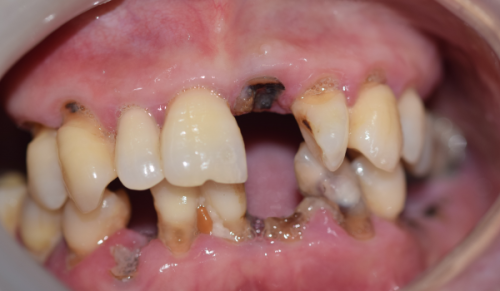 北京牙元素口腔怎么乘地铁去？别愁，这篇超详细的地铁出行攻略给你安排得明明白白