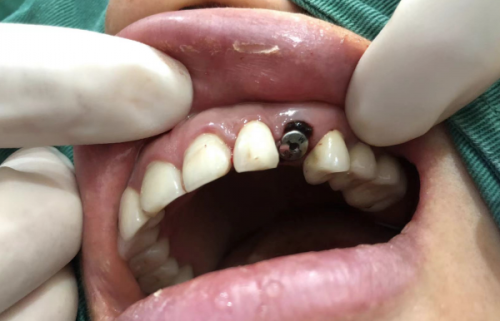 南京美奥口腔医院技术:精良前列,保护成效