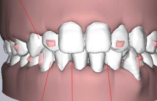 乌鲁木齐美奥口腔怎么样？正规靠谱技术好，医生经验丰富服务周到值得一去 
