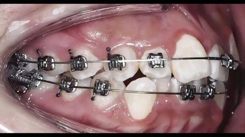 云南昆明松鼠口腔医院收费标准贵不贵？看完这篇分析你就心里有数了！ 