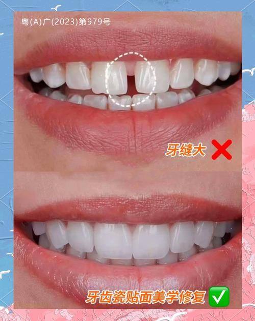 深圳蒙恩口腔诊所的专精医生团队