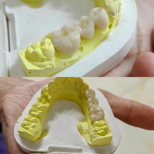 深圳蒙恩口腔诊所:正规靠谱,值得信赖