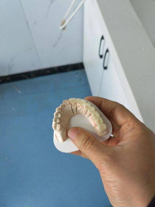 深圳蒙恩口腔诊所的精良技术与设备