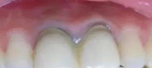 深圳蒙恩口腔诊所是正规的吗？没错，它正规靠谱，能提供专业口腔医美服务！ 