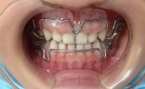 成都新桥口腔医院患者真实评价汇总