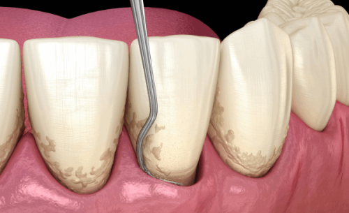 成都新桥口腔医院患者真实口碑反馈