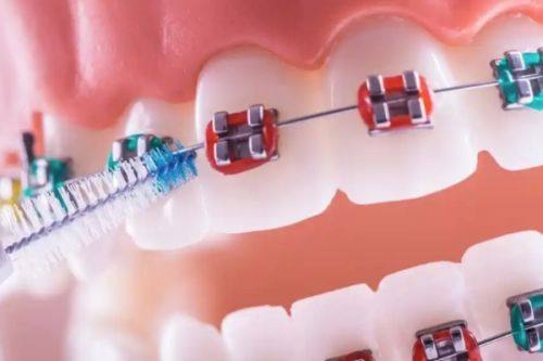 总结:北京禾禾齿科值得信赖