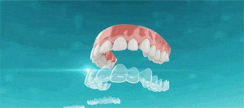 北京禾禾齿科口碑评价好不好？患者亲述正畸体验，技术服务双优值得信赖！ 