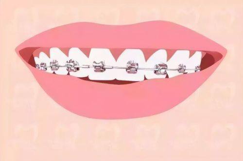 长沙美奥口腔医院值得信赖吗？医生团队+设备，确实是靠谱的口腔诊疗选择 