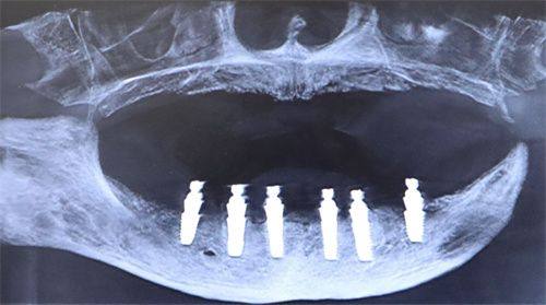 丽水亮贝美口腔门诊部:轻松预约看牙