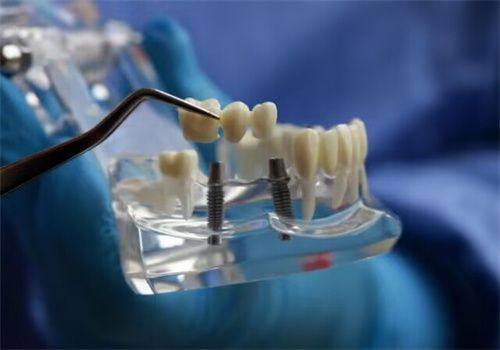 总结:丽水亮贝美口腔门诊部评价口碑怎么样?值得信赖!