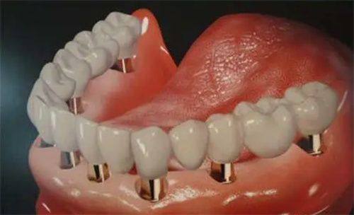 丽水牙科医院排名2025口碑榜及收费价目表:前一丽水亮贝美口腔出圈