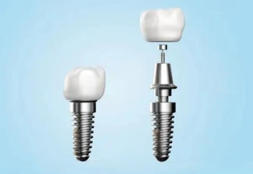 长沙美奥口腔医院:良好口碑见证实力