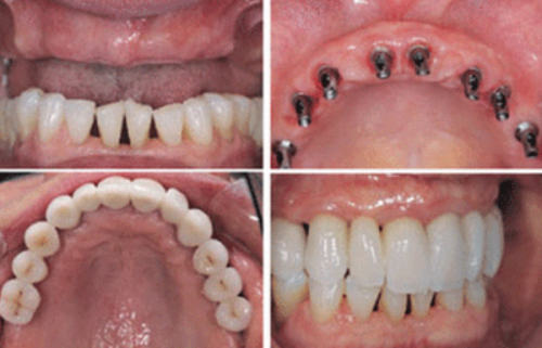 丽水亮贝美口腔看牙特点公开,收费不贵服务贴心网友都说值得一试!