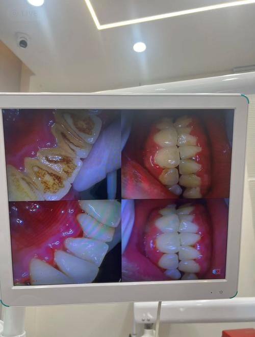 重庆维乐口腔医院收费情况