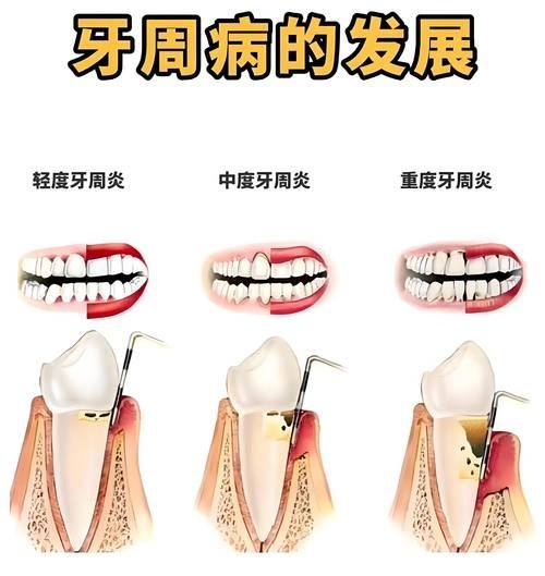 北京禾禾齿科张栋梁团队整牙技术与口碑