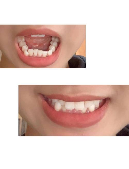 深圳格伦菲尔口腔(福田岗厦机构)的位置及交通