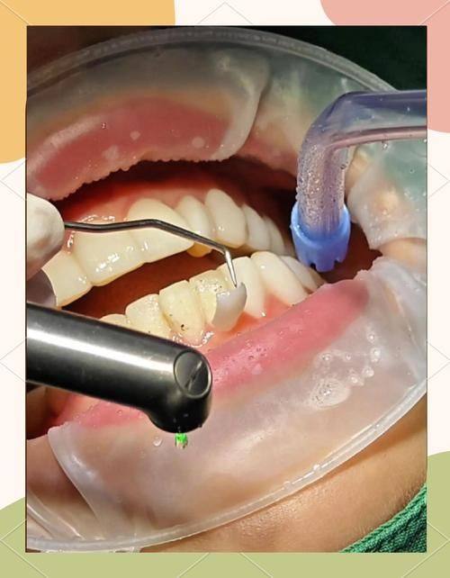 深圳格伦菲尔口腔(福田岗厦机构)的特色诊疗项目及价格