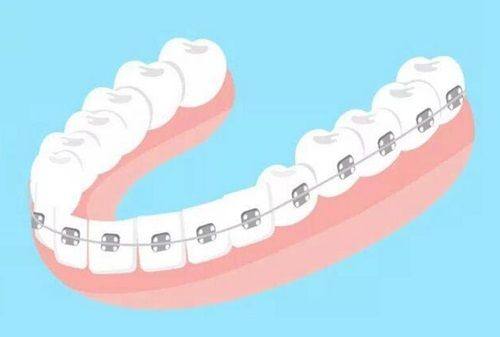 深圳铭德欧景口腔诊所的精良设备与齐全项目