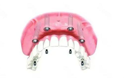 合肥美奥口腔医院正规靠谱吗?