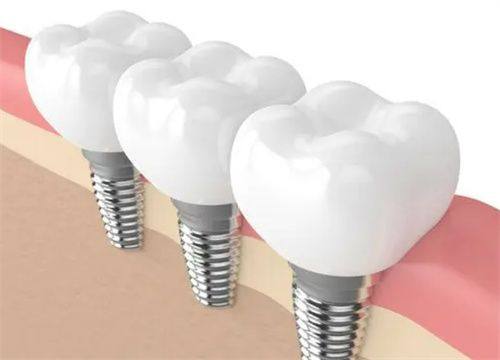 合肥美奥口腔医院评价口碑怎么样？顾客反馈技术棒服务佳，值得口腔患者信赖！ 