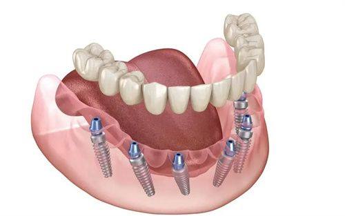 南充圣艾口腔门诊部:全方面的口腔诊疗服务