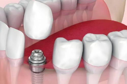 合肥美奥口腔医院价格情况