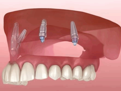 岳阳平江致远口腔医院医生团队与技术实力