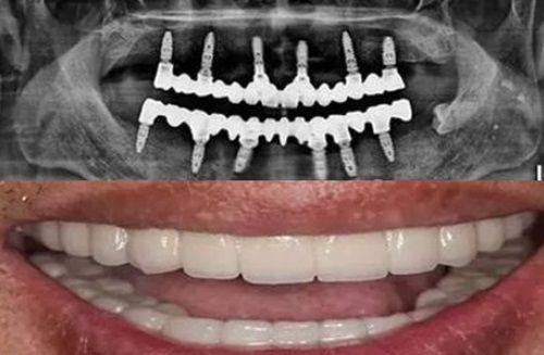 广州广大口腔医院禅城院区和南海院区地铁路线