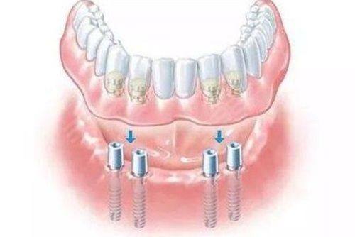 长沙美奥口腔医院的收费价格