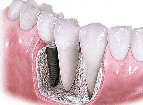 西安双宝口腔医院值得信赖吗？医生团队技术好，服务贴心，口碑不错值得选 