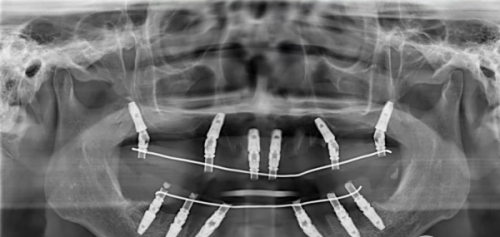 合肥美奥口腔医院口碑咋样,口碑实力绝绝子