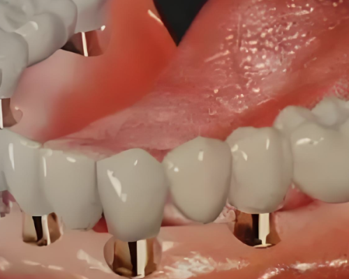 荆州中诺口腔医院靠谱吗?规模与服务显优势