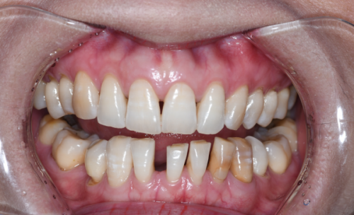 合肥美奥口腔医院正规吗?连锁资质口碑优,项目优惠多,医生实力强