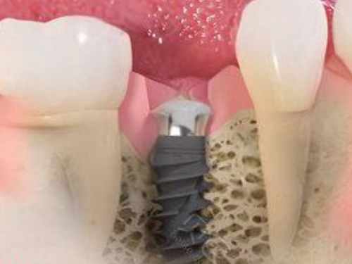 总结:西安小白兔口腔医院服务与技术实情揭秘