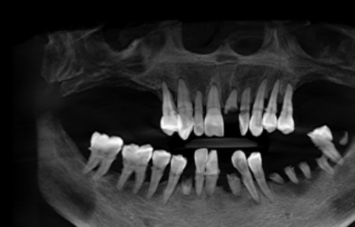 荆州中诺口腔医院坑不坑？来听听真实患者评价，再看是否值得选择！ 