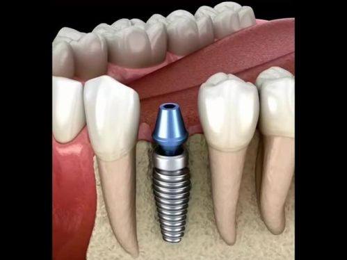 合肥美奥口腔医院是公立的吗？它是私立口腔医院，技术好服务佳很受当地市民认可 