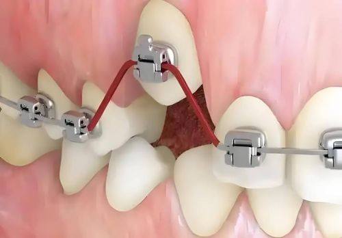 北京大学口腔医院2025年收费情况