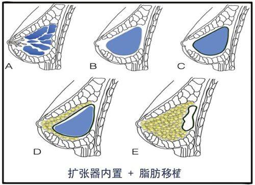 成都布莱梅联合口腔医院其他项目收费标准