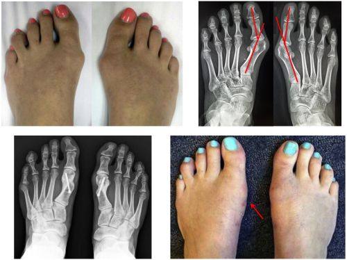 天津美奥口腔医院评价口碑怎么样？真实患者反馈，技术靠谱服务佳值得一去！ 