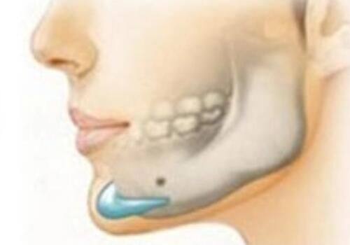 乌鲁木齐天牙口腔医院:专注高难度种植的实力派