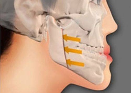 成都布莱梅联合口腔医院收费标准咋样？真实情况大揭秘，看完心里有数！ 