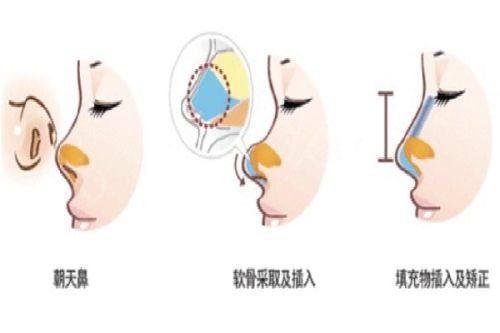 新疆乌鲁木齐美奥口腔:美学修复与儿童早期矫治的骨干医生